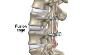 think-big-system-cervical-locking-plate