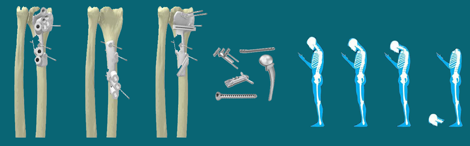 tbs-3d-printer-model